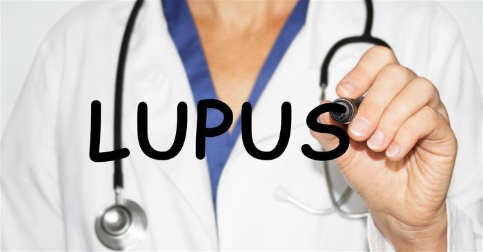 Nguyên nhân gây bệnh Lupus ban đỏ chủ yếu